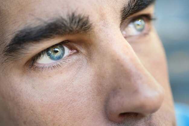 Почему глаза человека могут быть желтоватых оттенков?