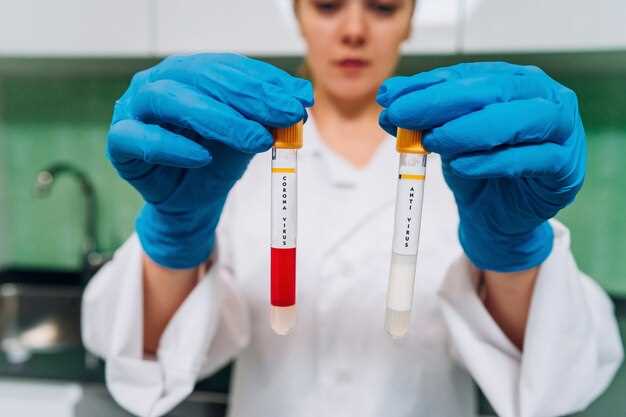 Роль общего билирубина в анализе крови