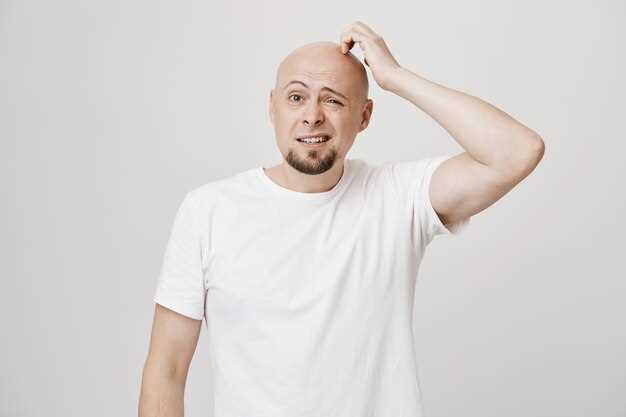 Простые и эффективные способы избавиться от лысины на голове у мужчин