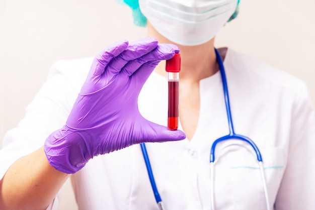 Как определяют спид в анализах крови