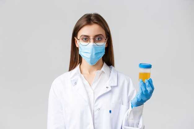 Как правильно подготовиться к анализу на мочевую кислоту