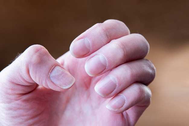 Грибки, проживающие на ногтях