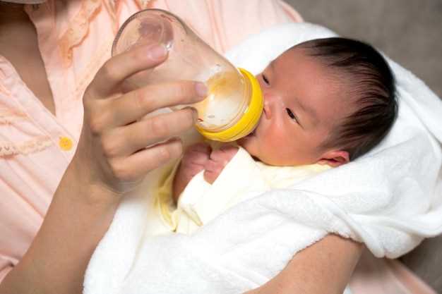 Как долго длится желтушка у новорожденных