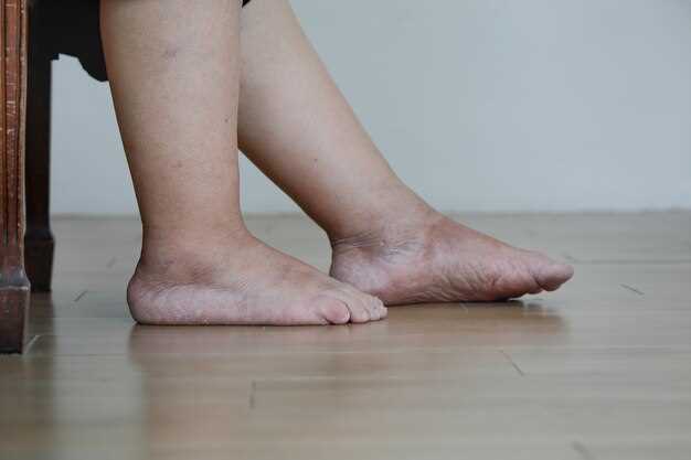 Почему возникают опухшие щиколотки на ногах