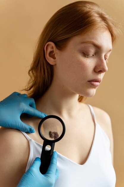 Факторы риска для возникновения рака кожи