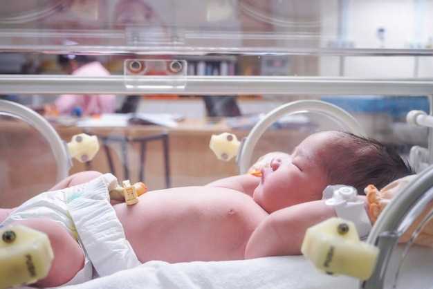 Сколько дней длится лечение с желтушкой новорожденных в родильном отделении