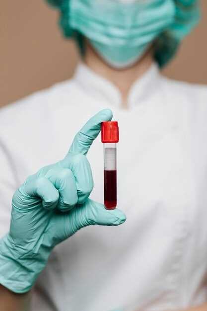 Критерии и обстоятельства анализа крови из вены