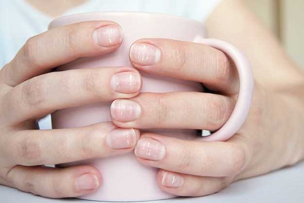 Методы лечения выпуклых ногтей на руках