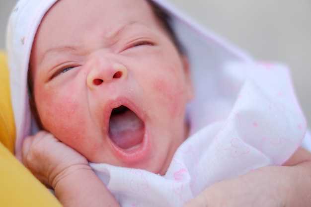 Забитый слезный канал у новорожденного: причины и лечение