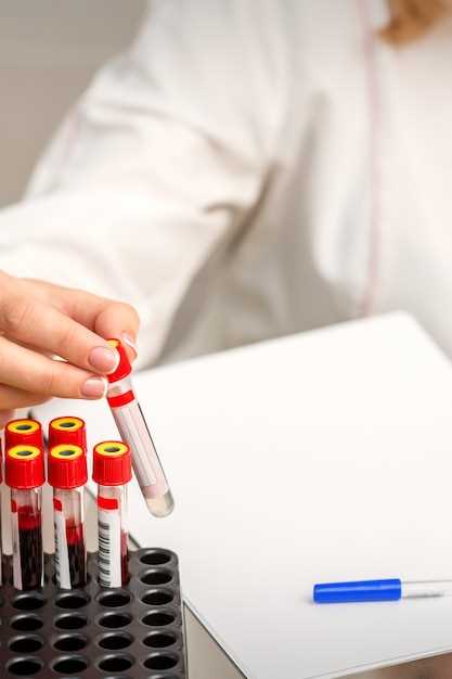 Причины для проведения биохимического анализа крови